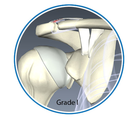 AC-grade-i